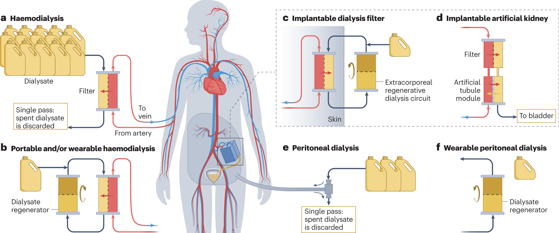 Diploma-Renal Dialysis Technician